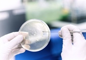 Antimicrobial susceptibility testing advances along with antimicrobial resistance threats